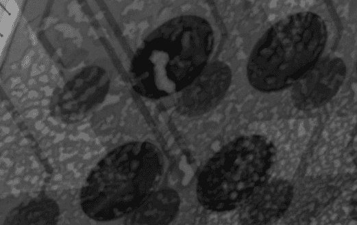 采购X-Ray避坑指南：质量总监最易忽略的10个陷阱与落地隐患