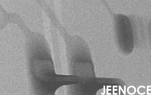 xray检测设备.png xray检测设备.png