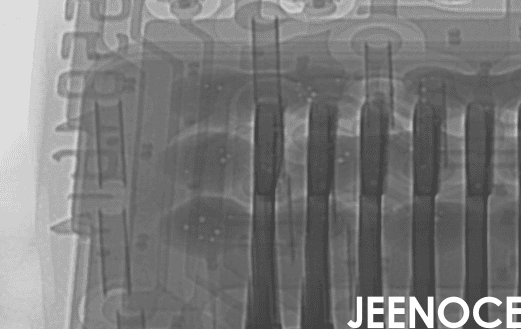 X-Ray检测中的误判与漏判：成因分析与系统性解决策略(图1)