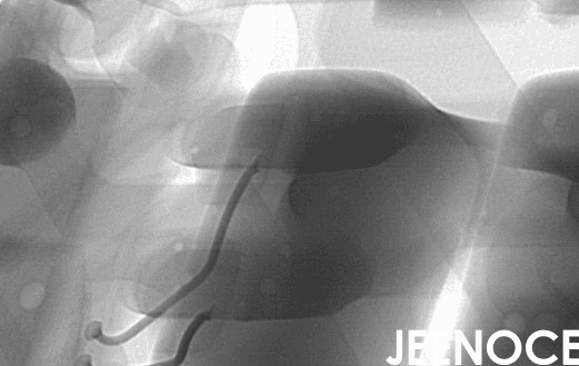 X-ray.png