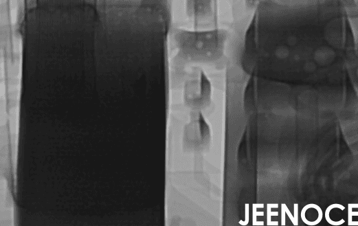 X-ray.png