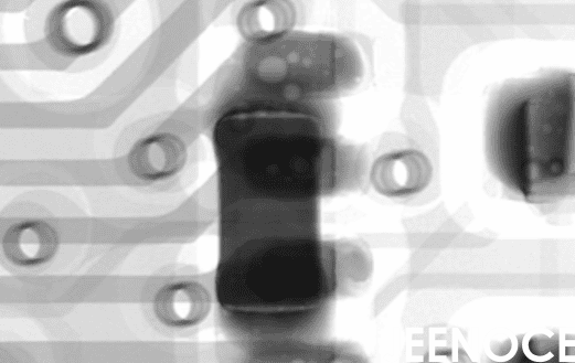 X-ray.png