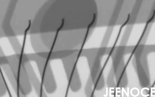X-ray.png X-ray.png