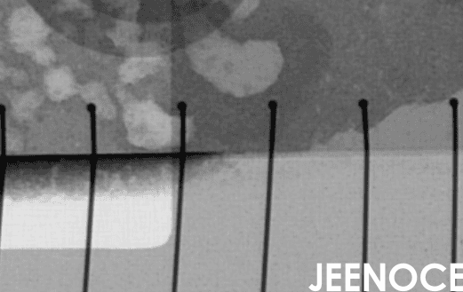 X-ray.png X-ray.png