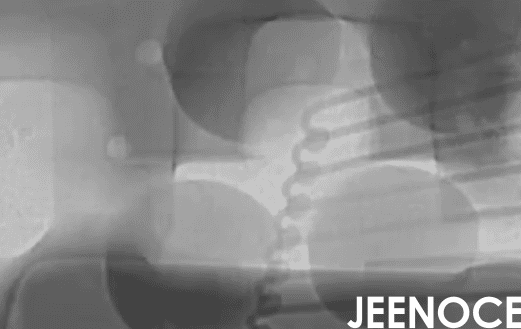 xray检测设备.png xray检测设备.png