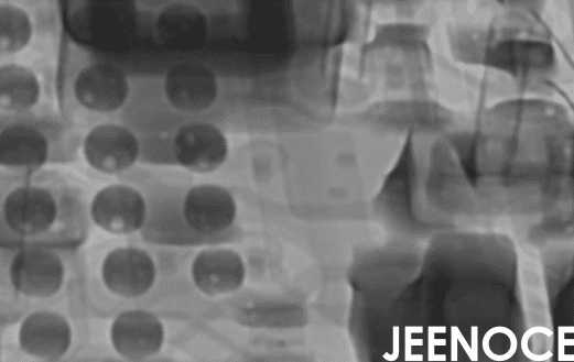 X-ray.png X-ray.png