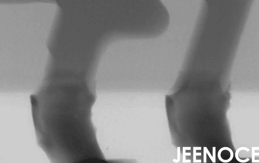 X-ray.png X-ray.png