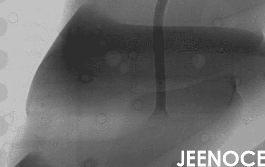 xray设备.png xray设备.png
