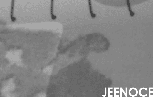 xray检测设备.png
