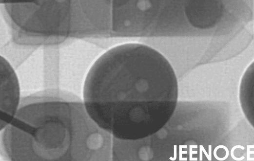 X-ray.png