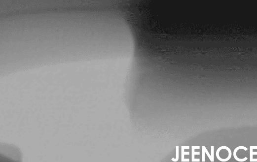 航空航天自动化产线质量控制：如何实现“零缺陷”生产(图1)