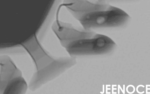 xray检测设备.png
