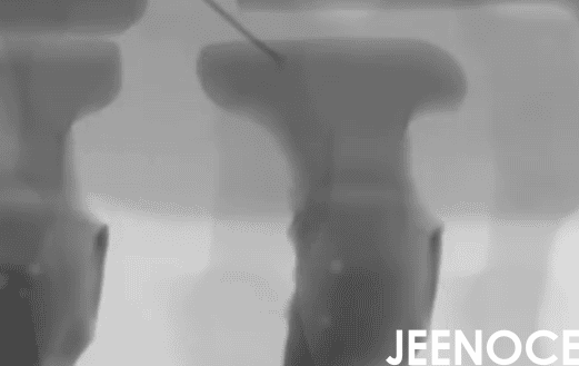 xray设备.png