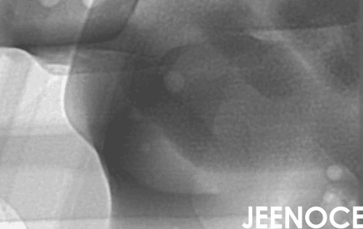 xray检测设备.png xray检测设备.png