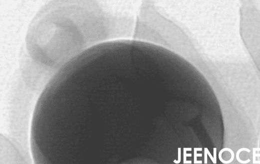 x-ray设备.png x-ray设备.png