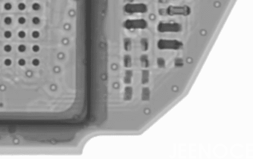 X-ray.png X-ray.png
