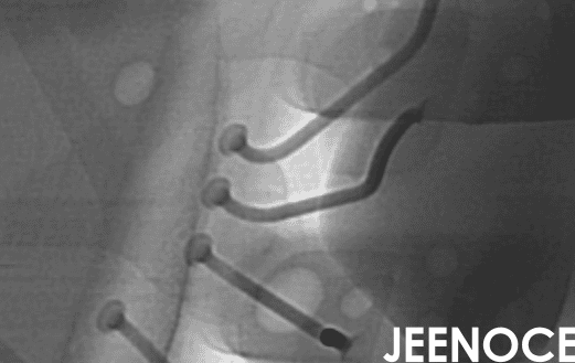 X-ray.png X-ray.png