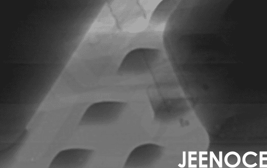 xray设备.png xray设备.png